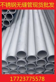 广安卫生级不锈钢管 进口卫生级不锈钢管 卫生级不锈钢管道304